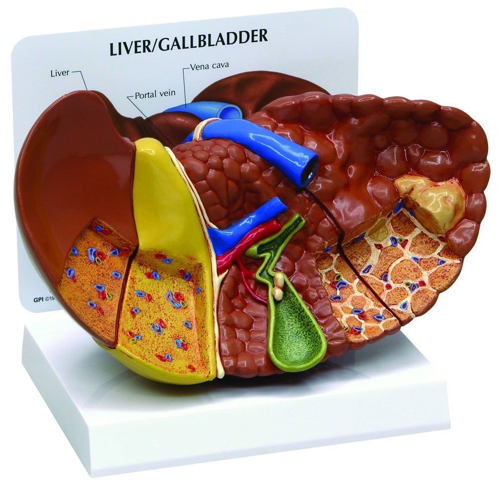 Pathological Model Of The Human Liver